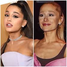 before and after